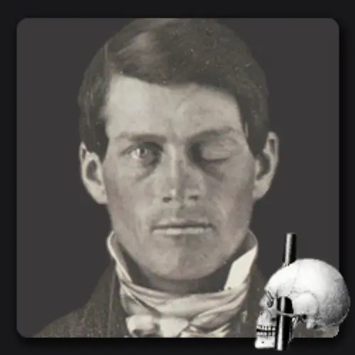 Phineas Gage